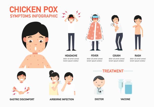 chicken pox symptoms infographic